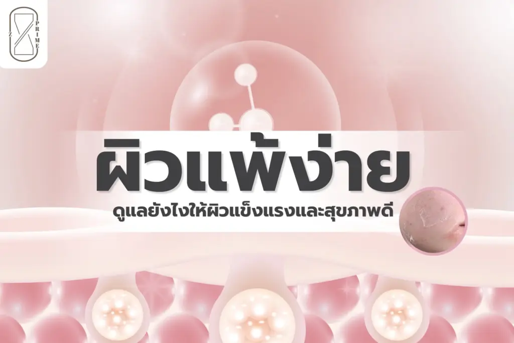 ผิวแพ้ง่าย