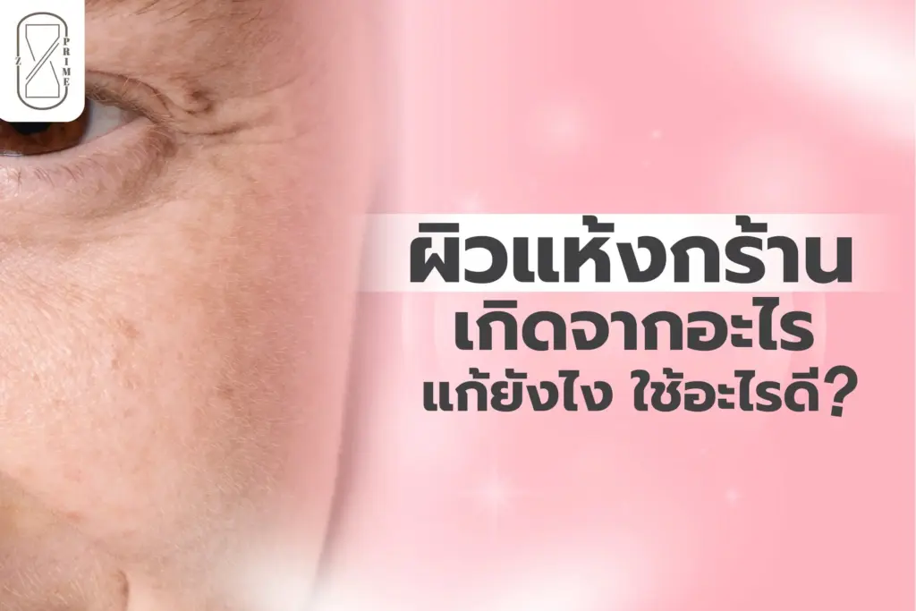 ผิวแห้งกร้าน